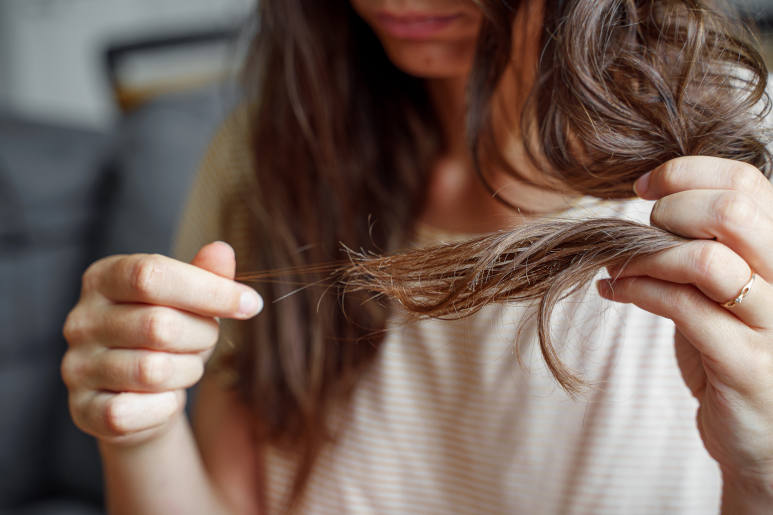 a woman accessing her hair loss from iron deficiency