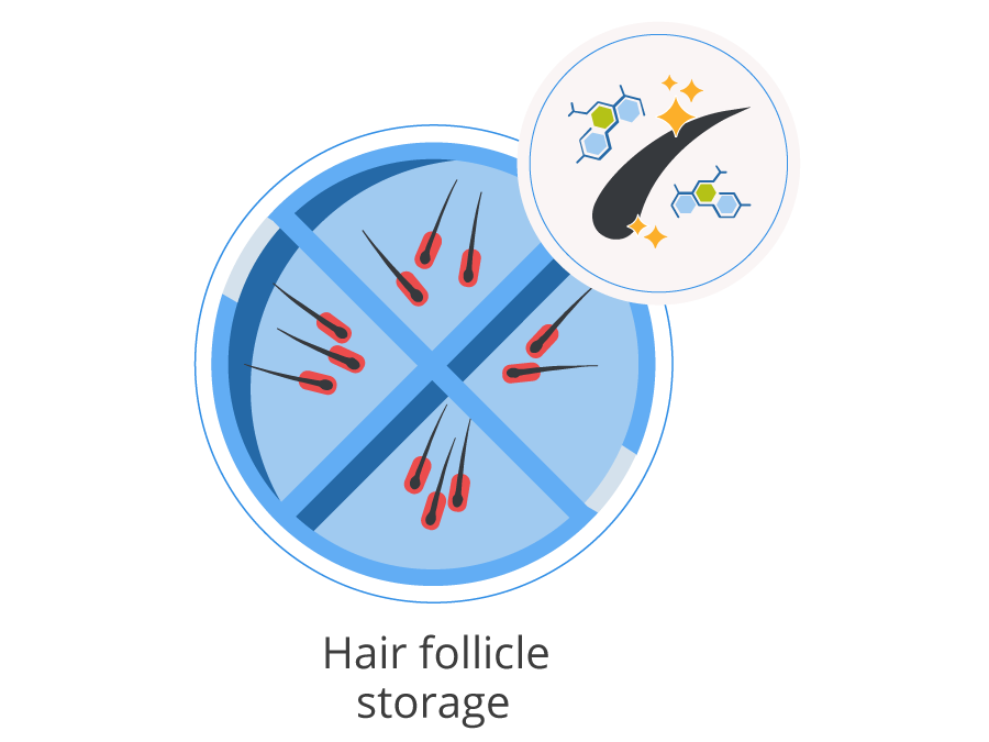 Infographic showing the hair follicle storage and enrichment before the hair transplant